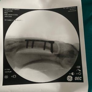 Meet your Posher, Shellz